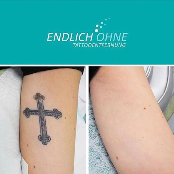 Bilder ENDLICH OHNE Tattooentfernung Filiale Berlin