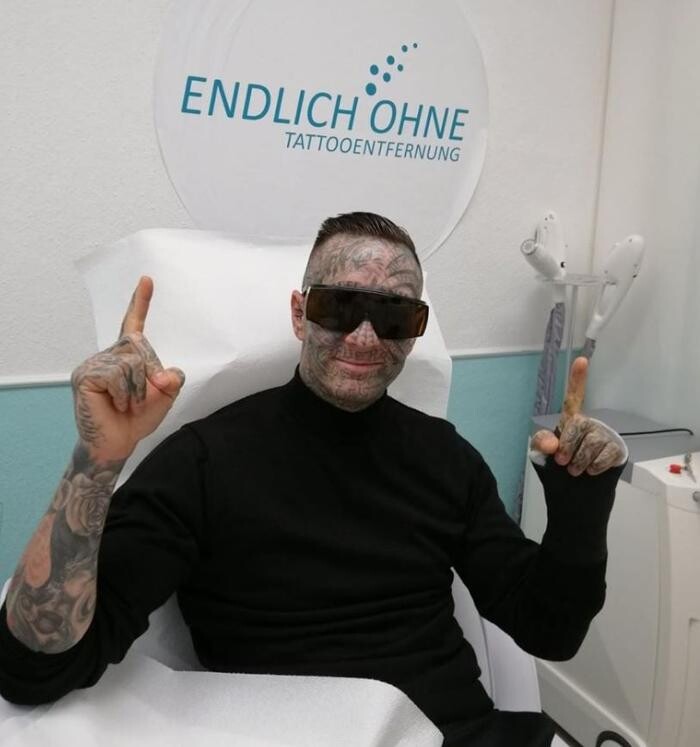 Bilder ENDLICH OHNE Tattooentfernung Filiale Heilbronn