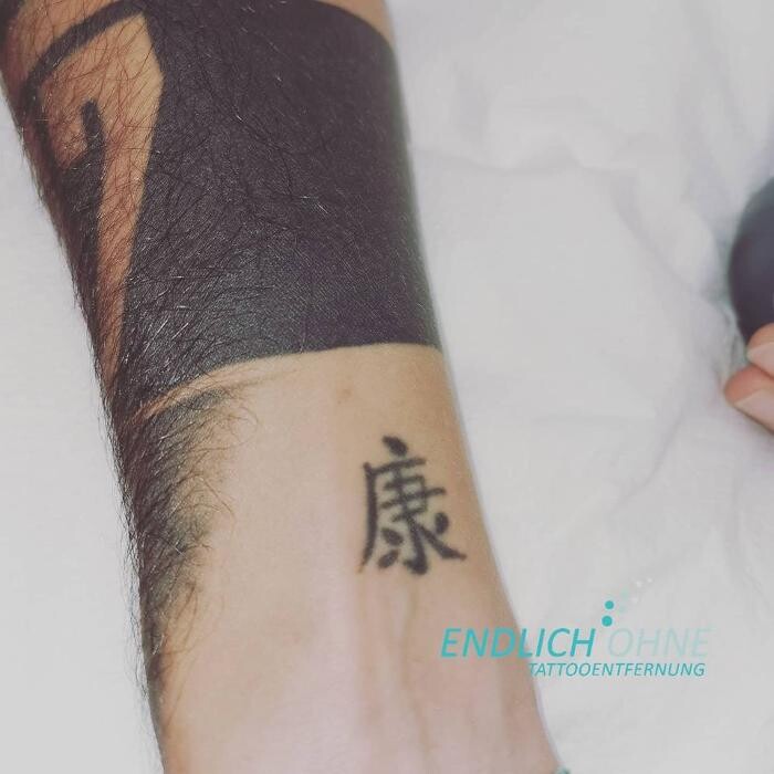 Bilder ENDLICH OHNE Tattooentfernung Filiale Fulda