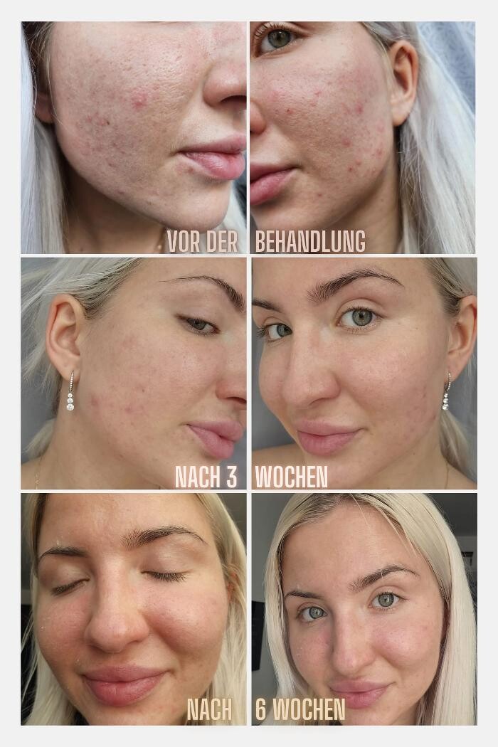 Bilder Kosmetikstudio ÄsthetikFee