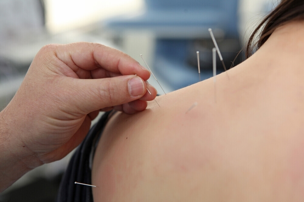 Bilder SpineCare Physiotherapie und Akupunkturpraxis Ch. Schulz