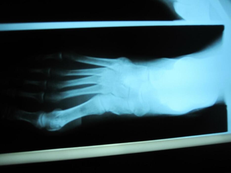 Images CLINICA DEL PIE ALBERTO DEL RIO