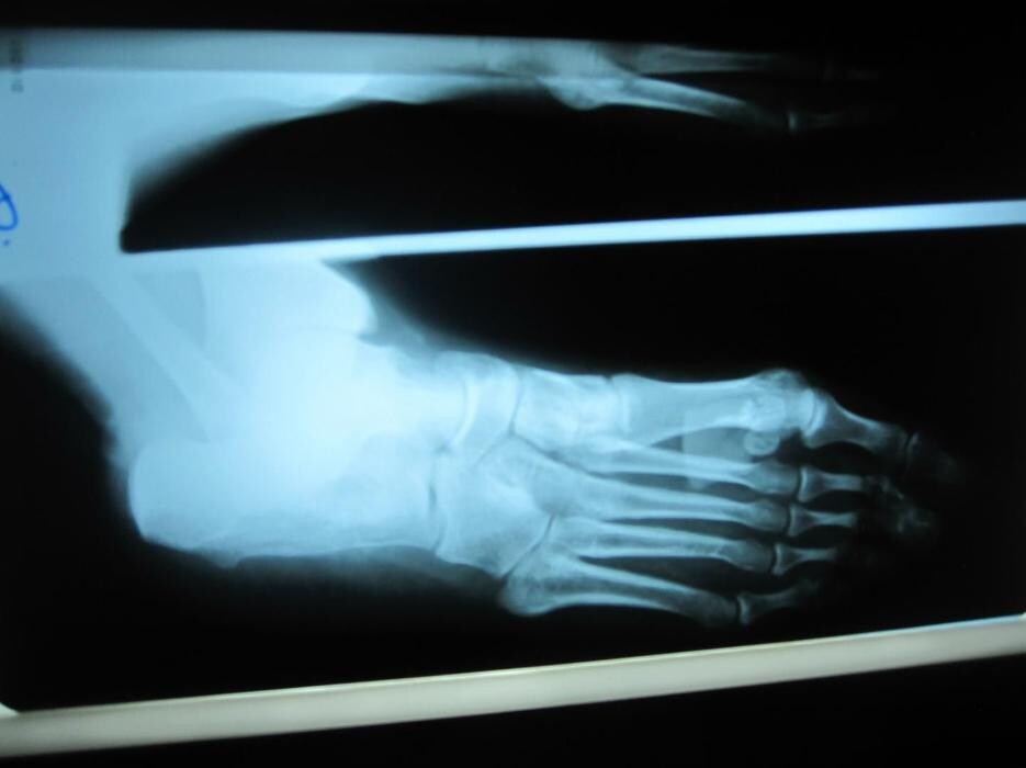 Images CLINICA DEL PIE ALBERTO DEL RIO