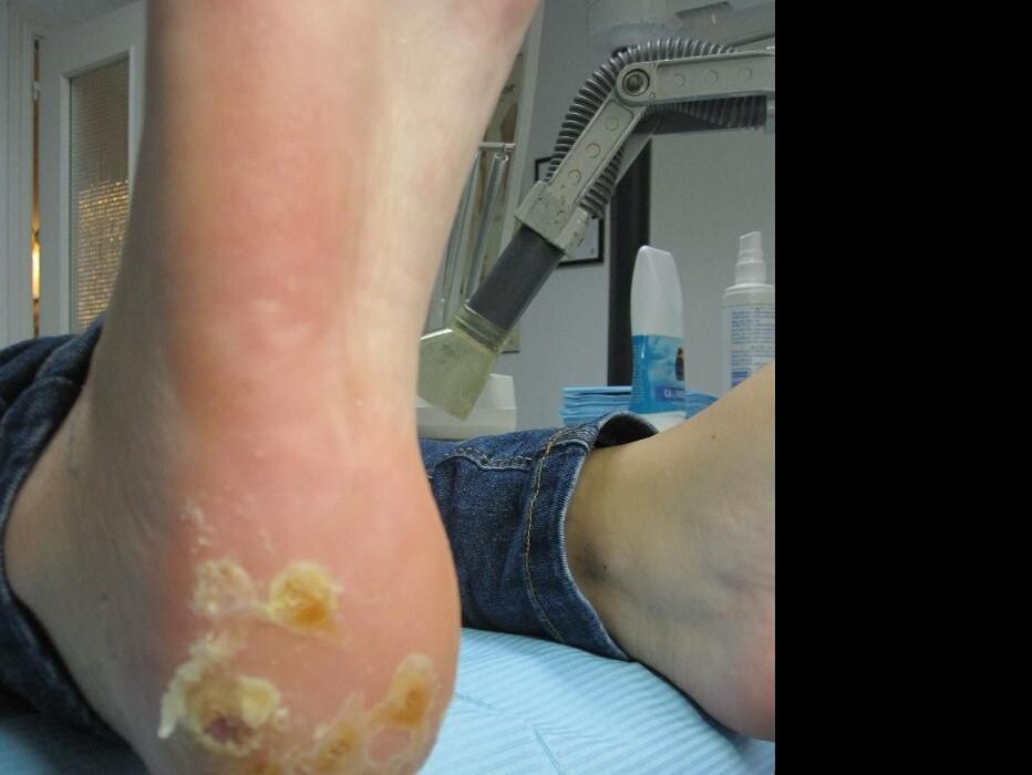 Images CLINICA DEL PIE ALBERTO DEL RIO