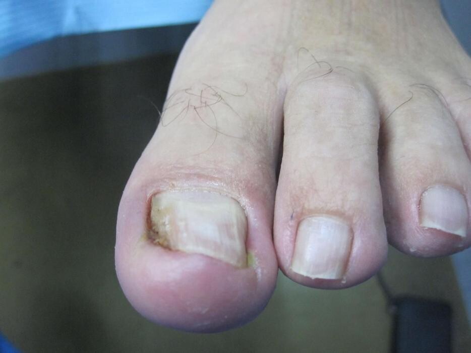 Images CLINICA DEL PIE ALBERTO DEL RIO