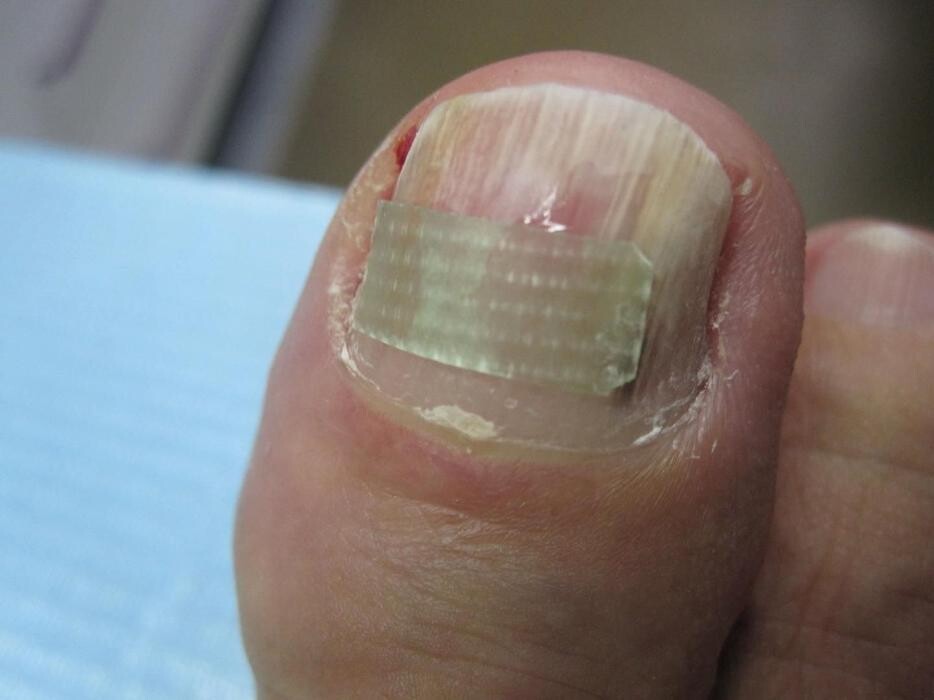 Images CLINICA DEL PIE ALBERTO DEL RIO