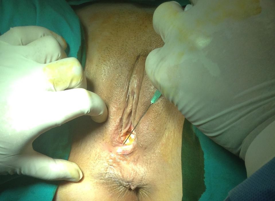 Images UNIDAD DE GINECOESTÉTICA LÁSER DR.FERNANDO AZNAR INSTITUTO CORDOBES DE GINECOLOGÍA
