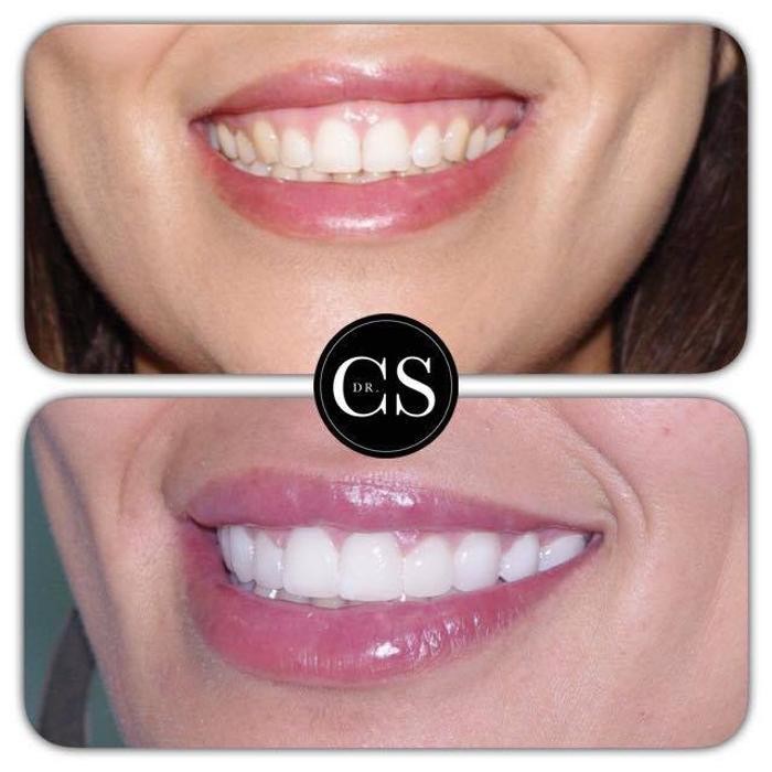 Images Carlos Saiz Smile