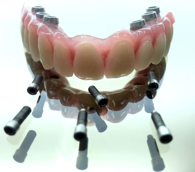 Images Laboratorio Dental J C