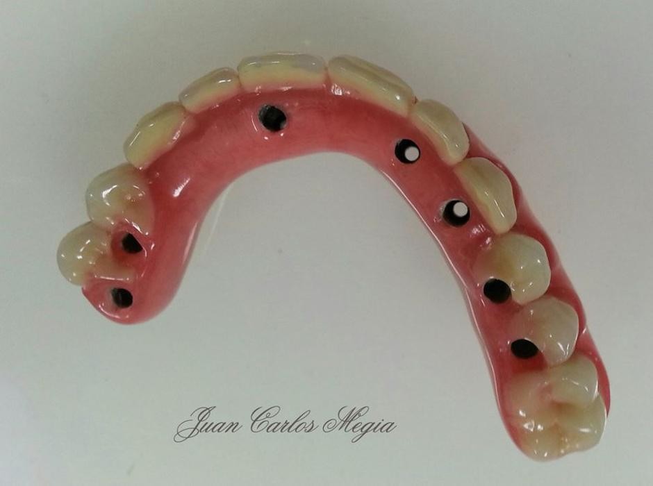 Images Laboratorio Dental J C