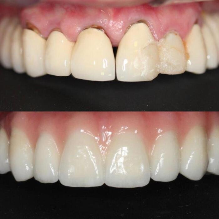 Images Clínica Dental Reina Victoria 66
