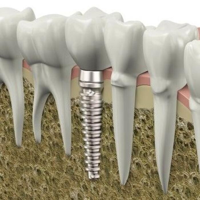 Images Clínica Dental Reina Victoria 66