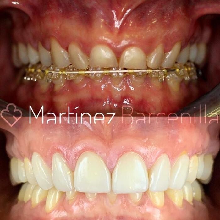 Images Clínica Dental Reina Victoria 66