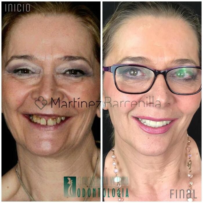 Images Clínica Dental Reina Victoria 66