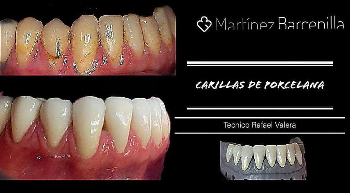 Images Clínica Dental Reina Victoria 66
