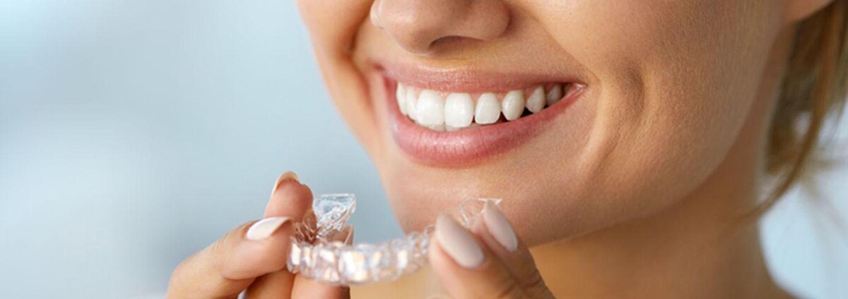 Images Clínica Dental Reina Victoria 66