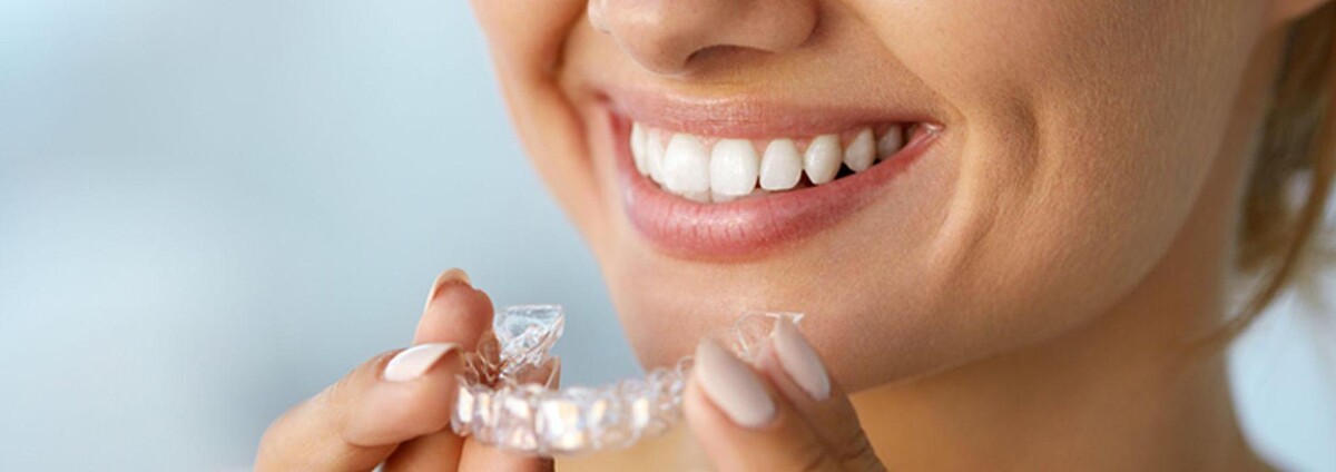 Images Clínica Dental Reina Victoria 66