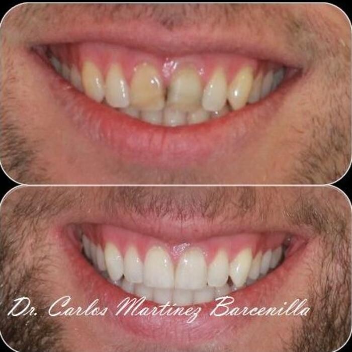 Images Clínica Dental Reina Victoria 66