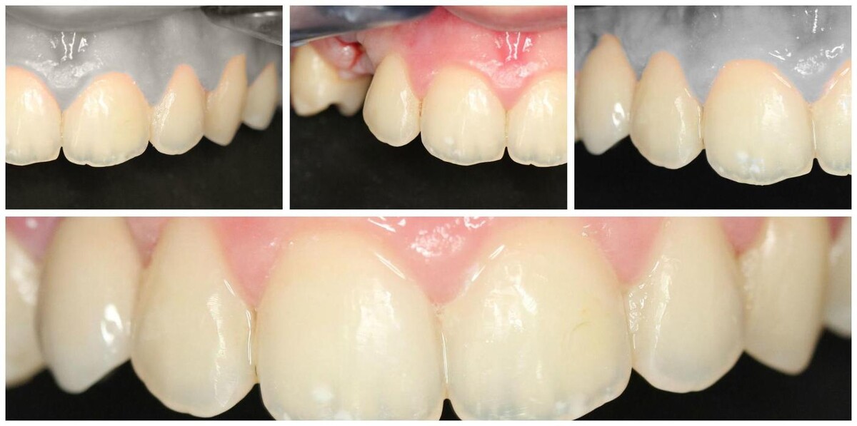 Images Clínica Dental Reina Victoria 66