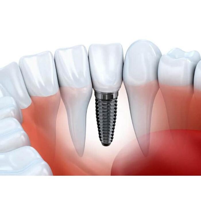 Images CLINICA DENTAL BAIX PREUS