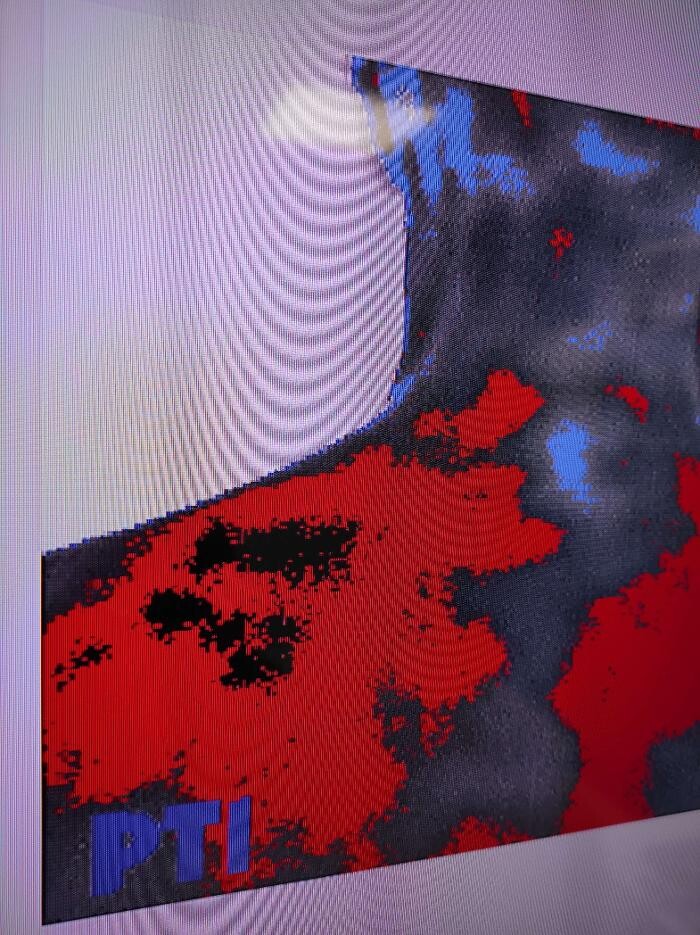 Images Fisioterapia Océano Móstoles