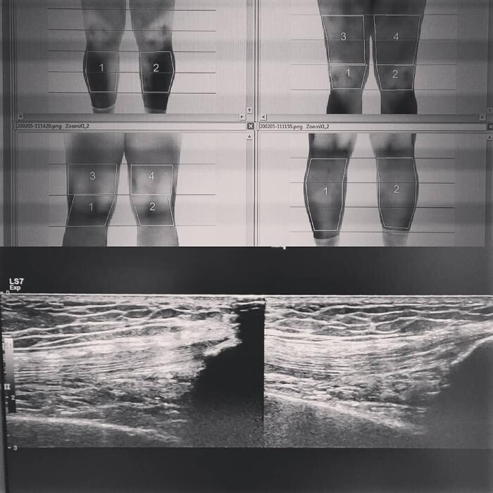 Images Fisioterapia Océano Móstoles