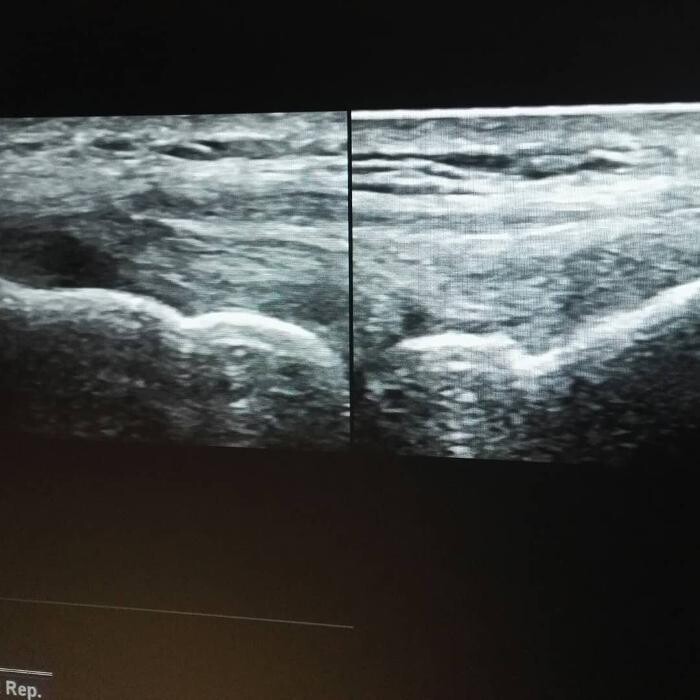 Images Fisioterapia Océano Móstoles