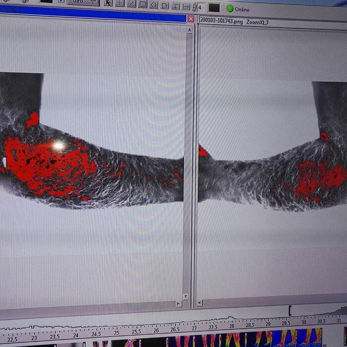 Images Fisioterapia Océano Móstoles