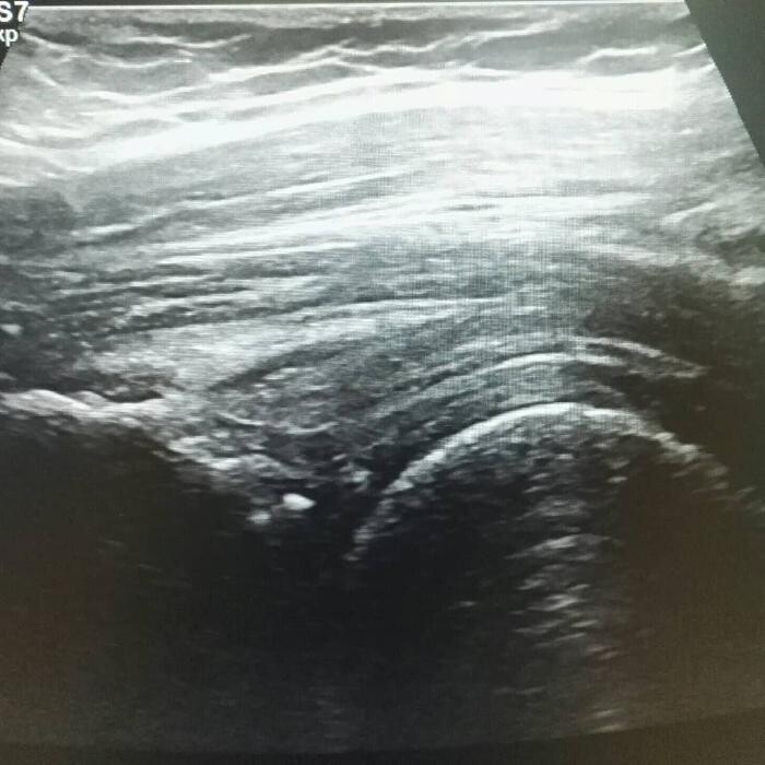 Images Fisioterapia Océano Móstoles