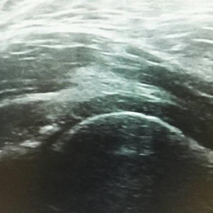 Images Fisioterapia Océano Móstoles