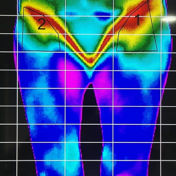 Images Fisioterapia Océano Móstoles