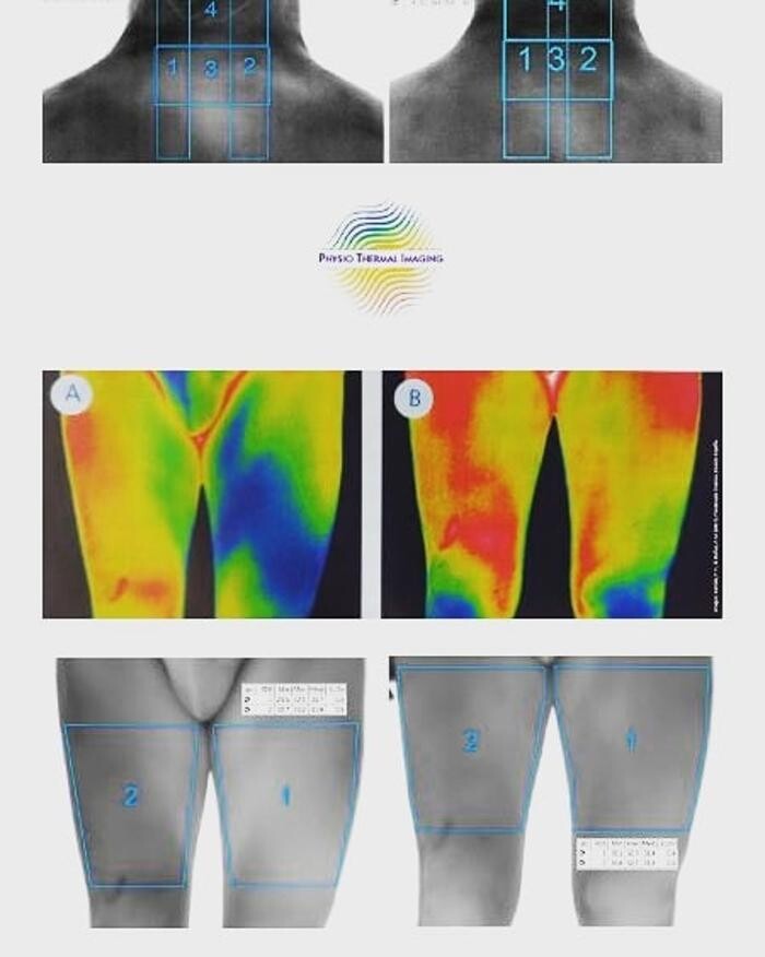 Images Fisioterapia Océano Móstoles