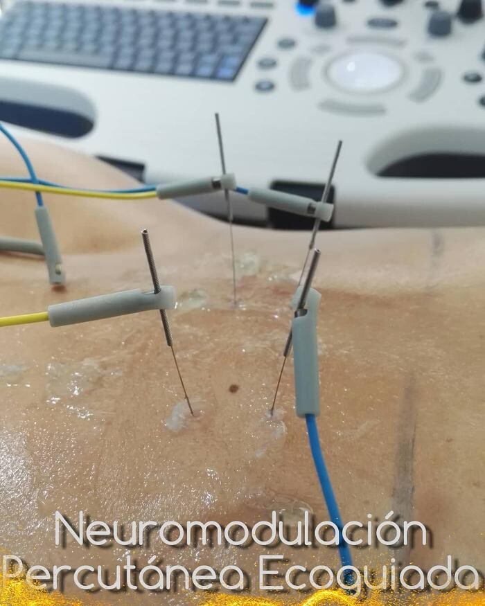 Images Fisioterapia Océano Móstoles