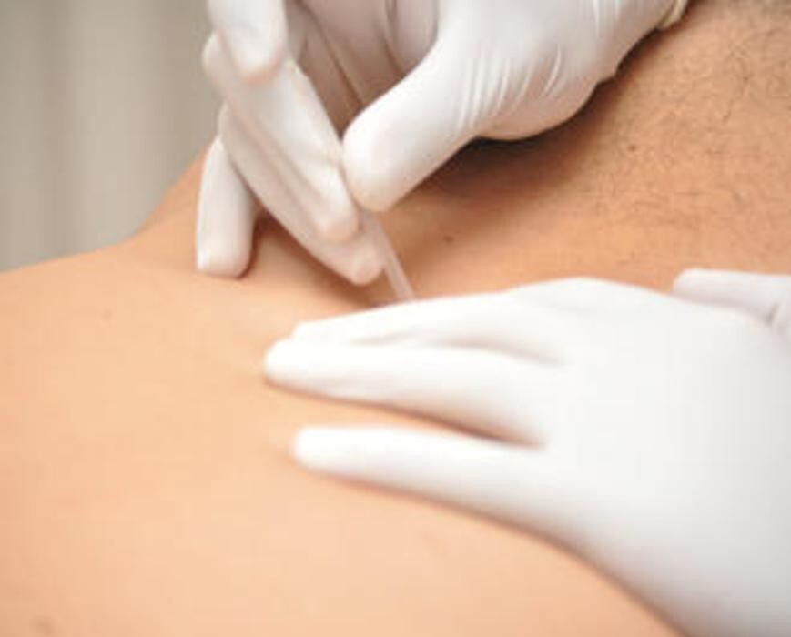 Images Fisioterapia Océano Móstoles