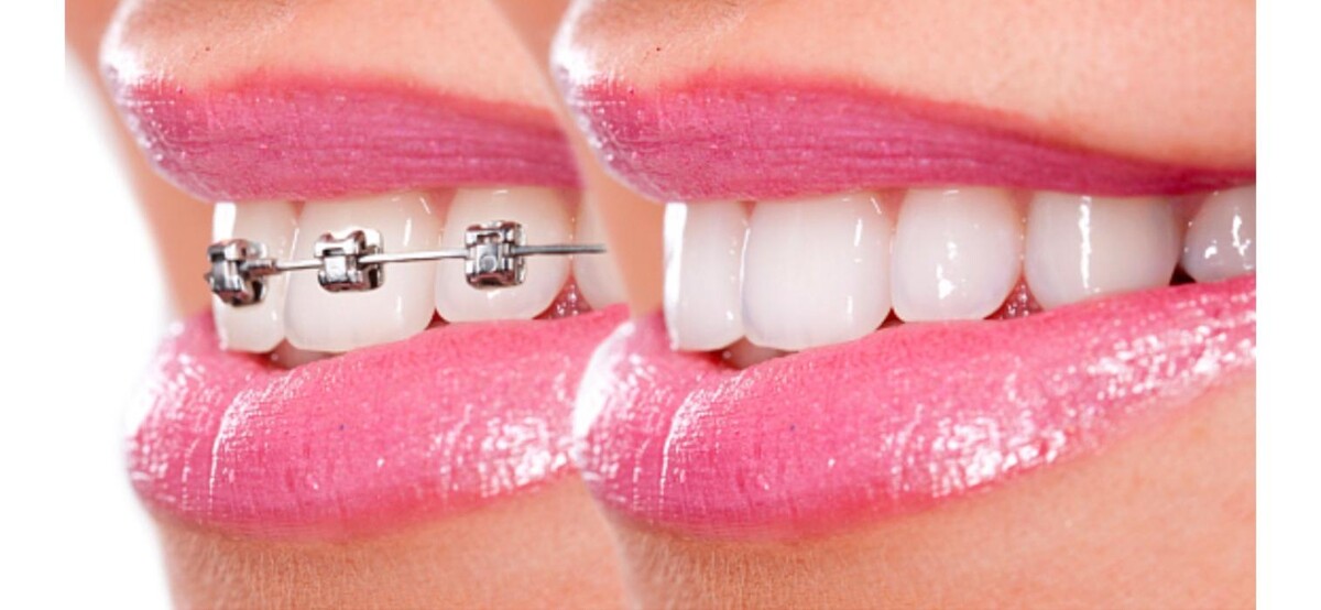 Images CLINICA DENTAL CEID