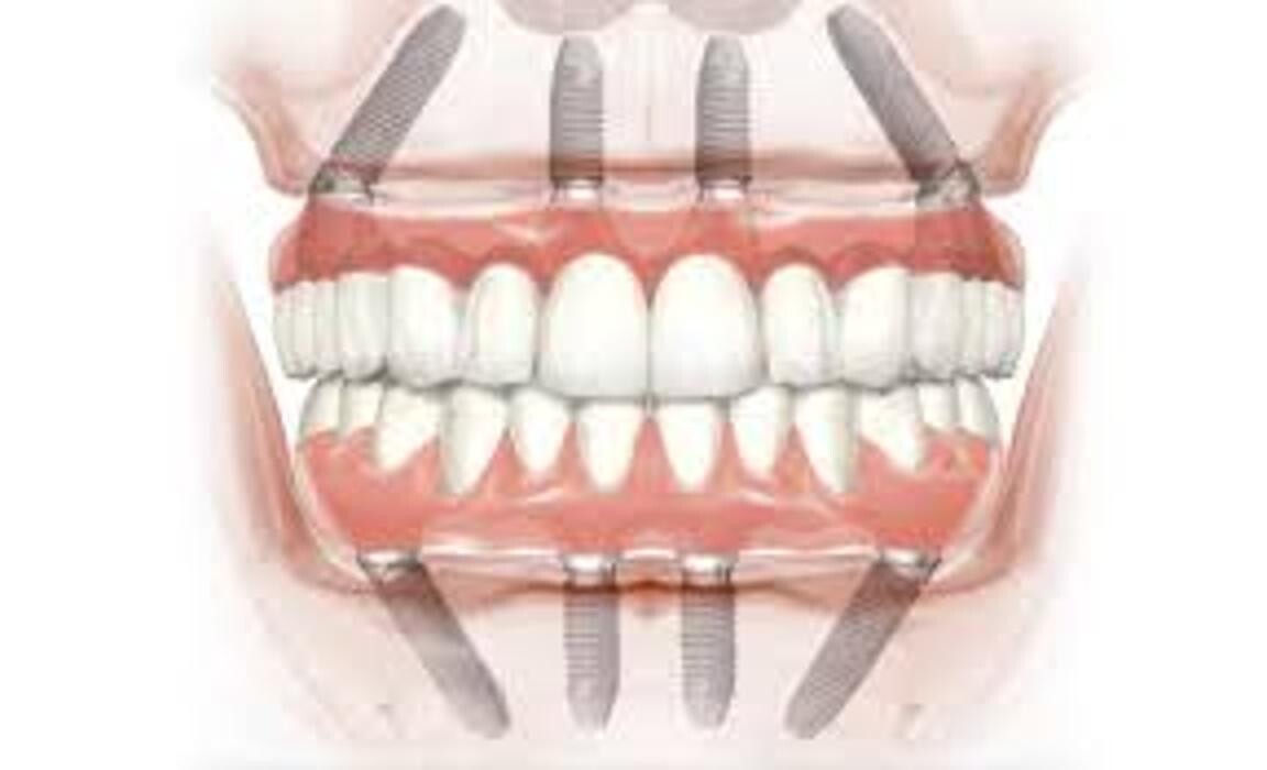 Images CLINICA DENTAL CEID