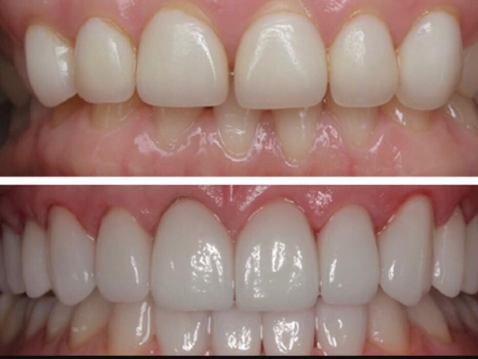 Images CLINICA DENTAL CEID