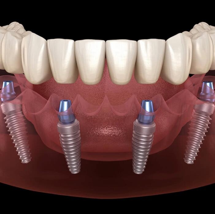 Images CLINICA DENTAL CEID