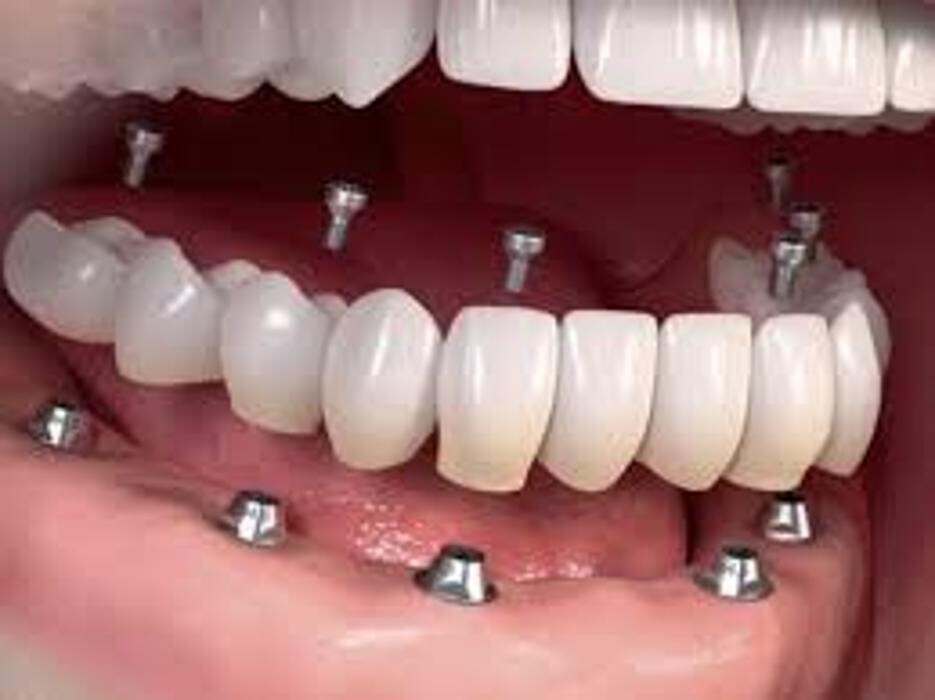 Images CLINICA DENTAL CEID