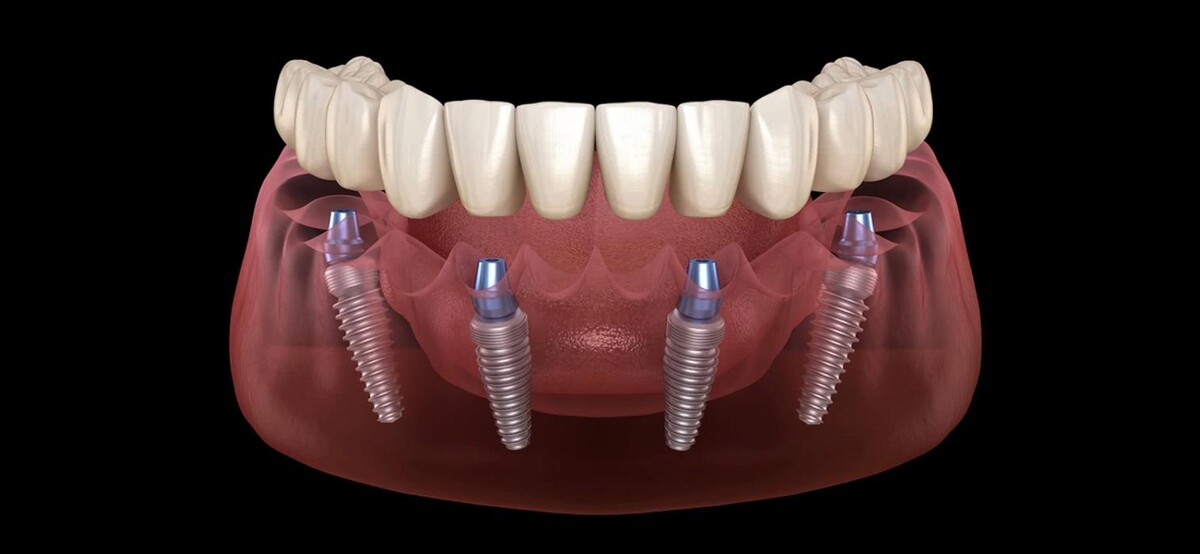 Images CLINICA DENTAL CEID