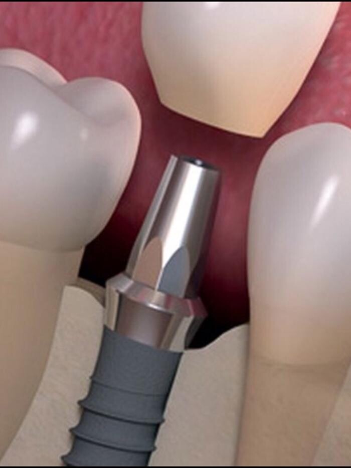 Images CLINICA DENTAL CEID