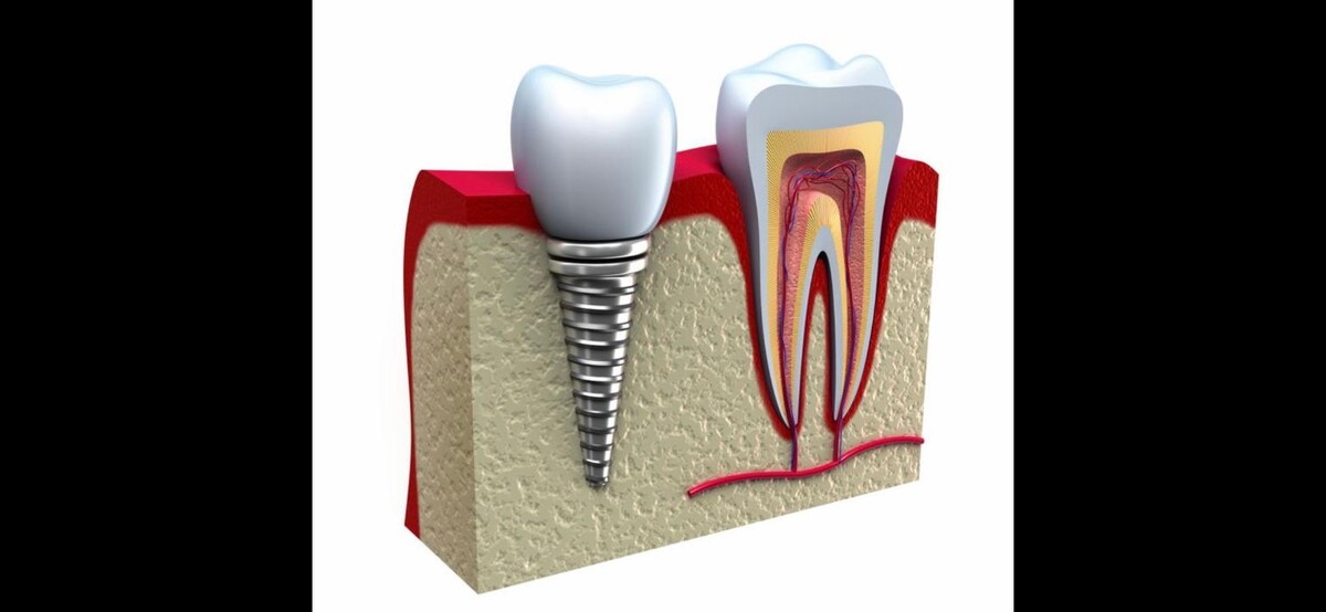 Images CLINICA DENTAL CEID