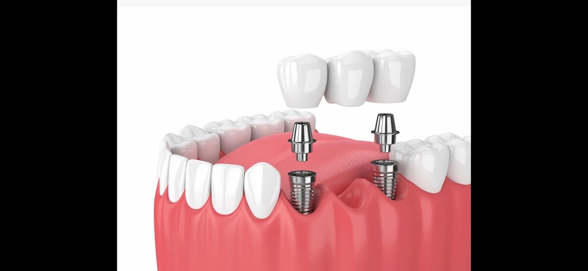 Images CLINICA DENTAL CEID