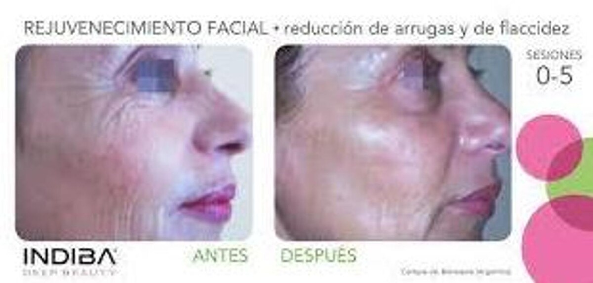 Images Ciudad Alta Clinica De Fisioterapia y Audiología