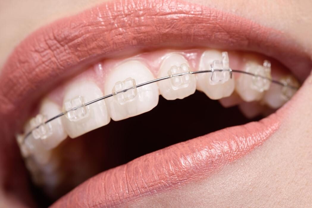 Images Clínica Dental Las Redes