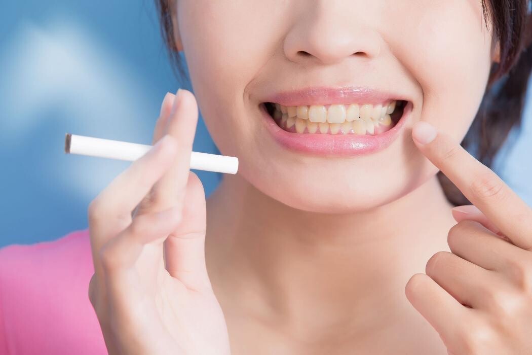 Images Molydental