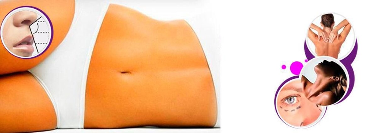 Images Palma Estetic