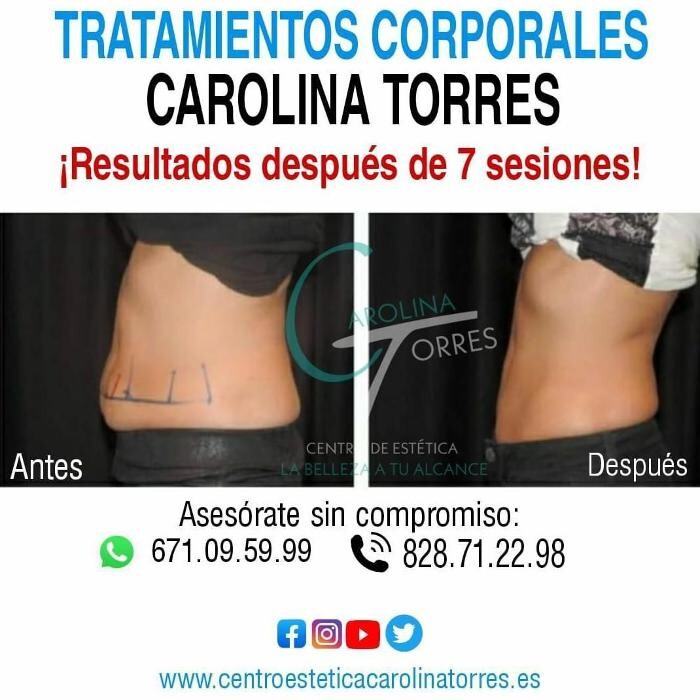 Images Centro De Estetica Carolina Torres