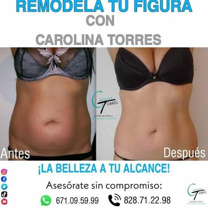Images Centro De Estetica Carolina Torres