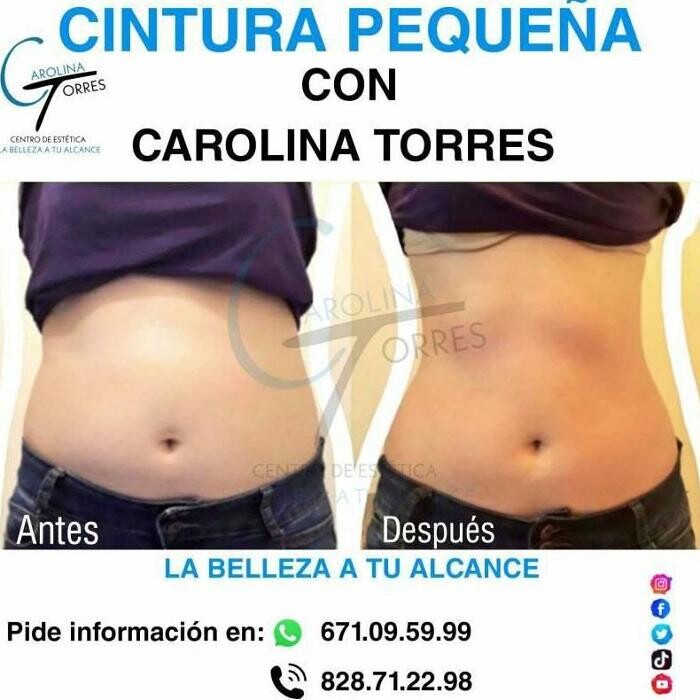 Images Centro De Estetica Carolina Torres